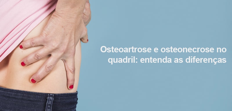 Os sintomas são parecidos, mas existem grandes diferenças entre a osteoartrose e osteonecrose no quadril. Entenda as causas e como se prevenir!