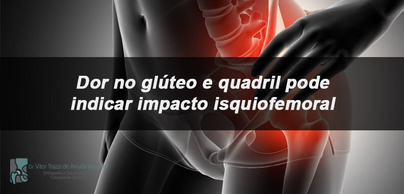 O impacto isquiofemoral é um problema que causa dor profunda no glúteo e quadril. A dor pode irradiar pela coxa ou região inguinal.