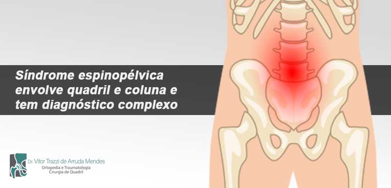 Descubra no blog do Dr Vitor Trazzi como a síndrome espinopélvica afeta coluna e quadril. Quais os sintomas, diagnóstico e tratamentos.