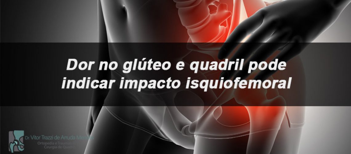 O impacto isquiofemoral é um problema que causa dor profunda no glúteo e quadril. A dor pode irradiar pela coxa ou região inguinal.