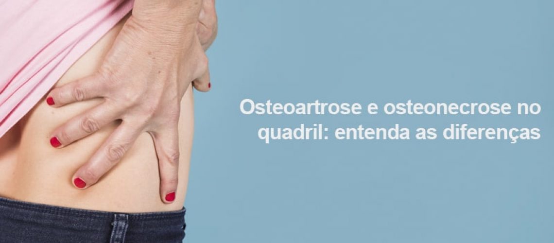 Os sintomas são parecidos, mas existem grandes diferenças entre a osteoartrose e osteonecrose no quadril. Entenda as causas e como se prevenir!