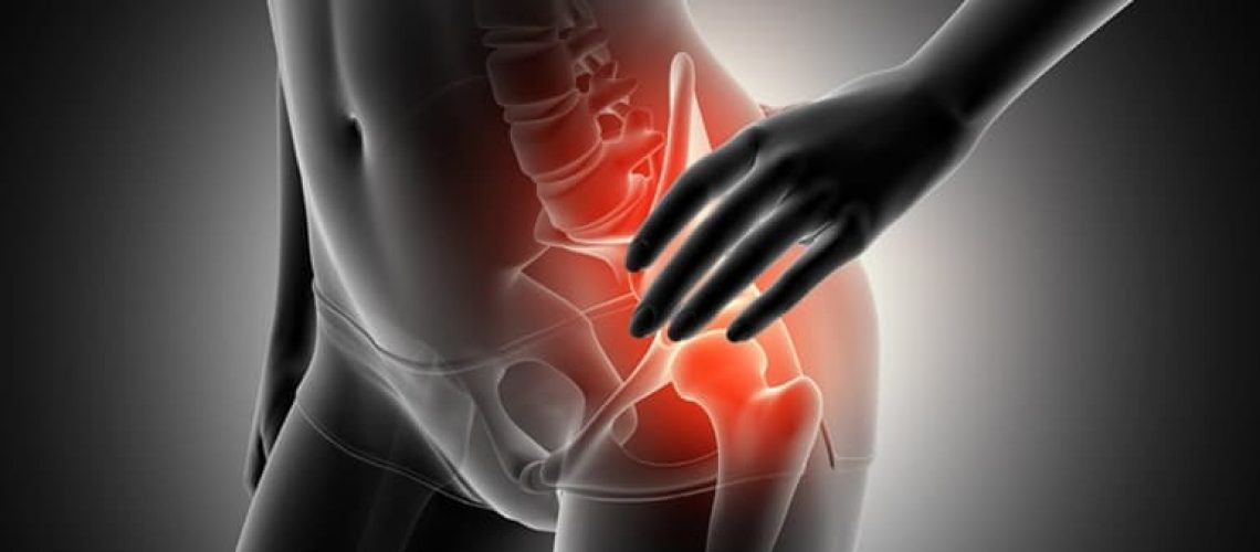 A Síndrome de Impacto Femoroacetabular (ou IFA - Impacto Femoroacetabular) pode causar fortes dores no quadril, limitando a mobilidade do corpo e a qualidade de vida. Pessoas nesta condição devem procurar ajuda e tratamento adequado com um médico ortopedista especialista em quadril.